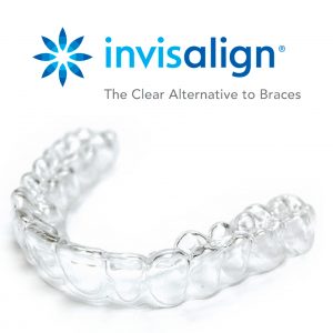 invisalign
