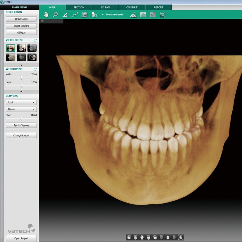 Dental Referral Service Arnica Dental Care Cheltenham