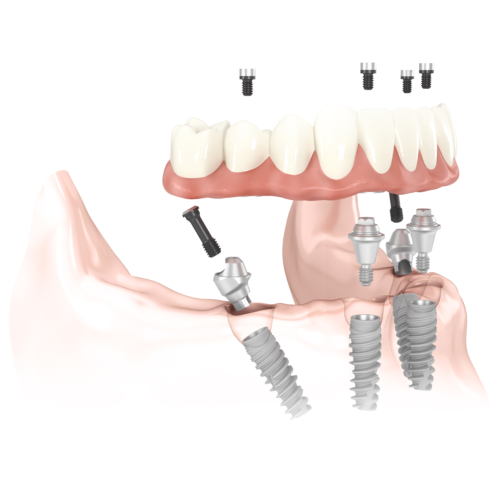 referral dentist