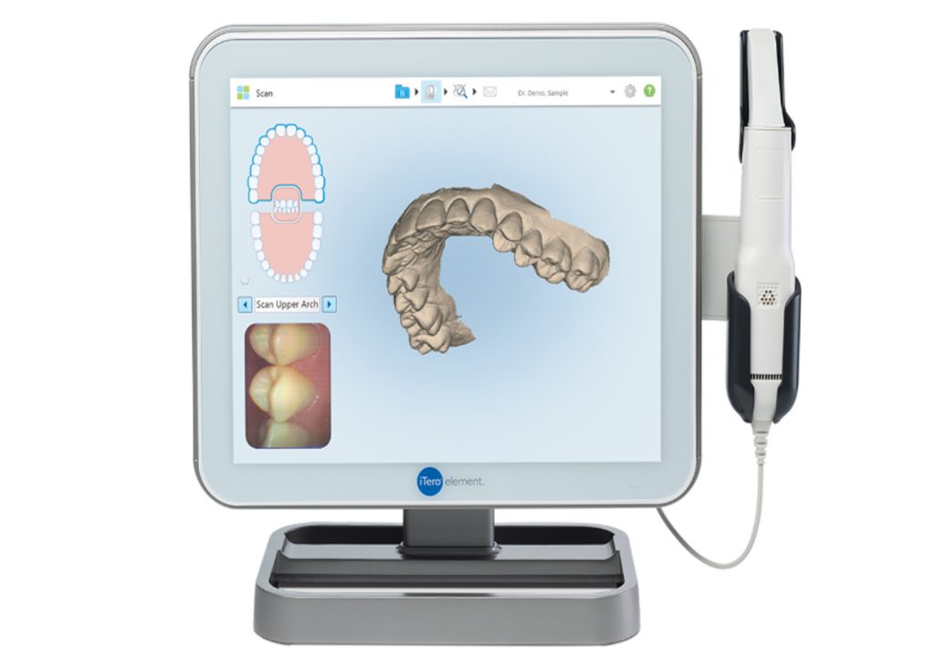 Itero intraoral scanner screen