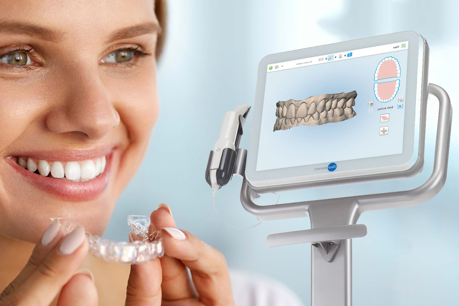 Itero intraoral scanner Arnica Dental Care