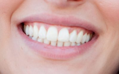 Patient Smile 1