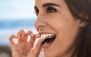 Woman wearing Invisible dental braces