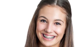 Girl wearing traditional Dental Braces