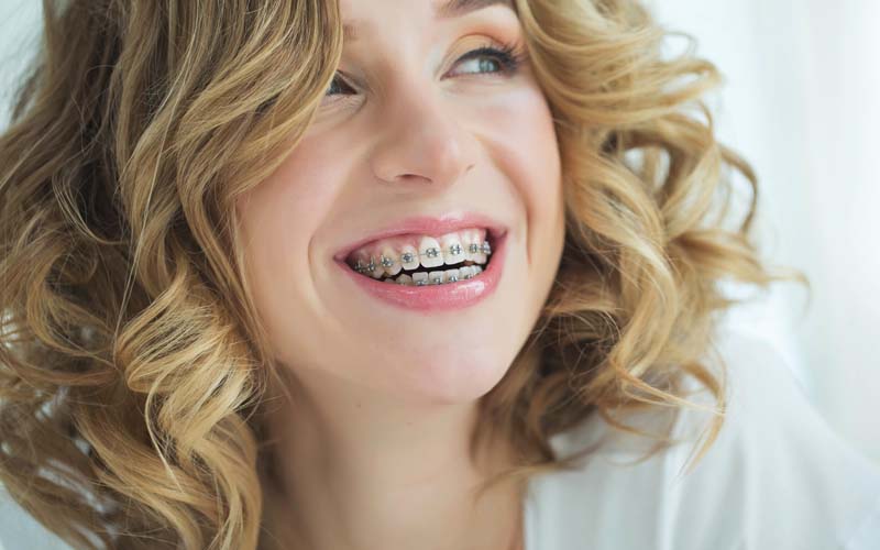 Traditional Metal Braces Young Woman