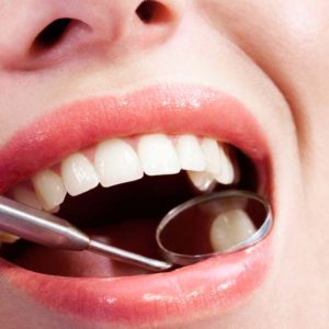 Invisible fillings via dental mirror 2