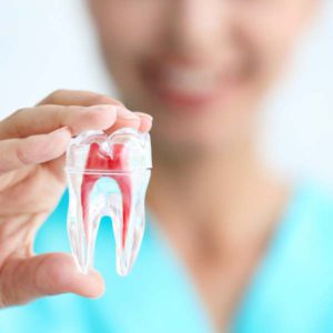 Root Canal Treatment Model