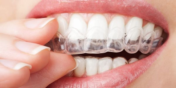 Winter Teeth Whitening Banner Image 2
