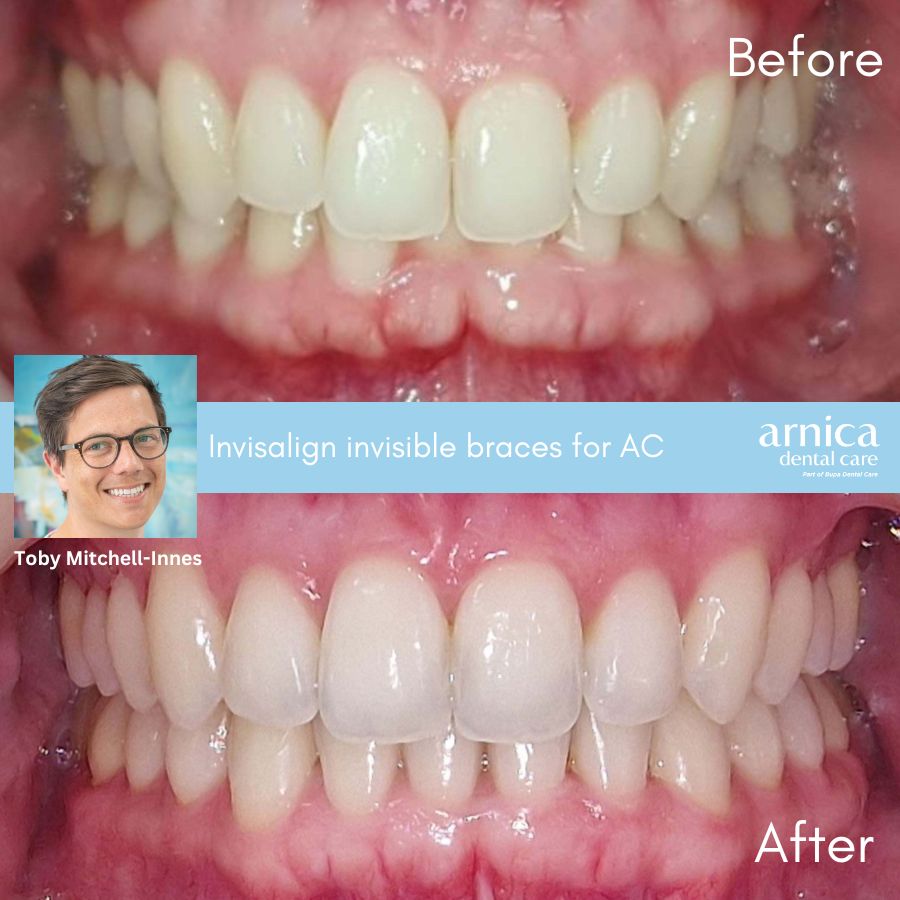 AC Before and After - Webpage